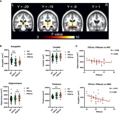 Glial receptor PLXNB2 regulates schizophrenia-related stress perception via the amygdala
